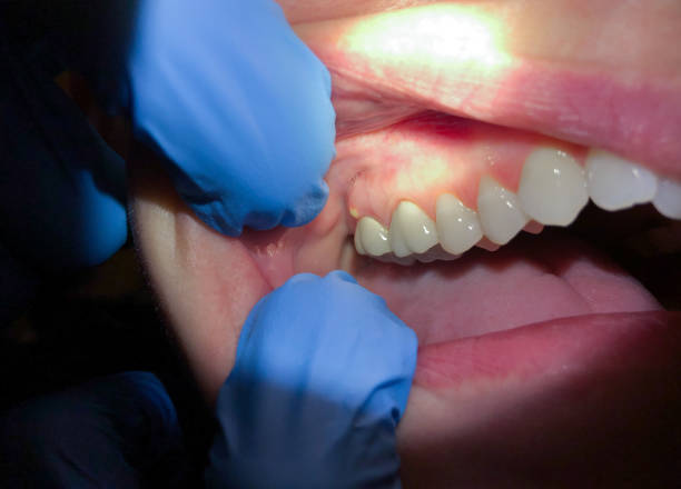 Professional Emergency Dental Service in VA